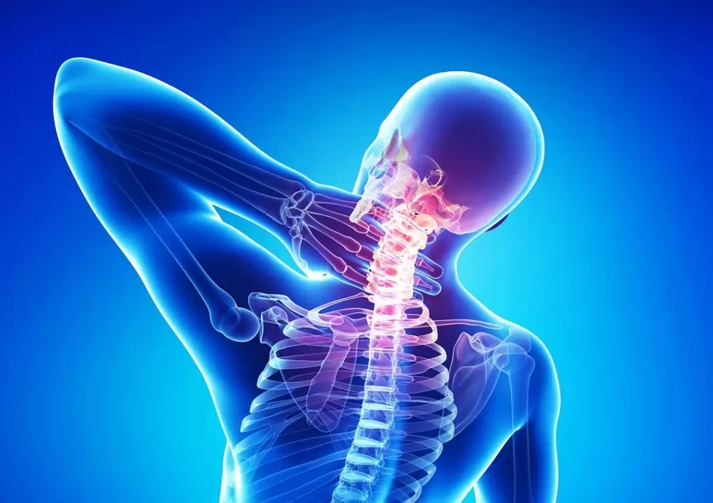 osteochondróza je ochorenie chrbtice