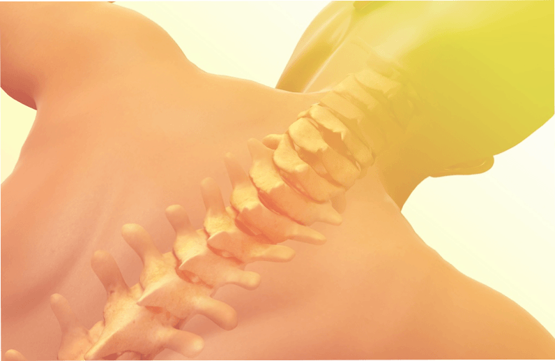 osteochondróza chrbtice