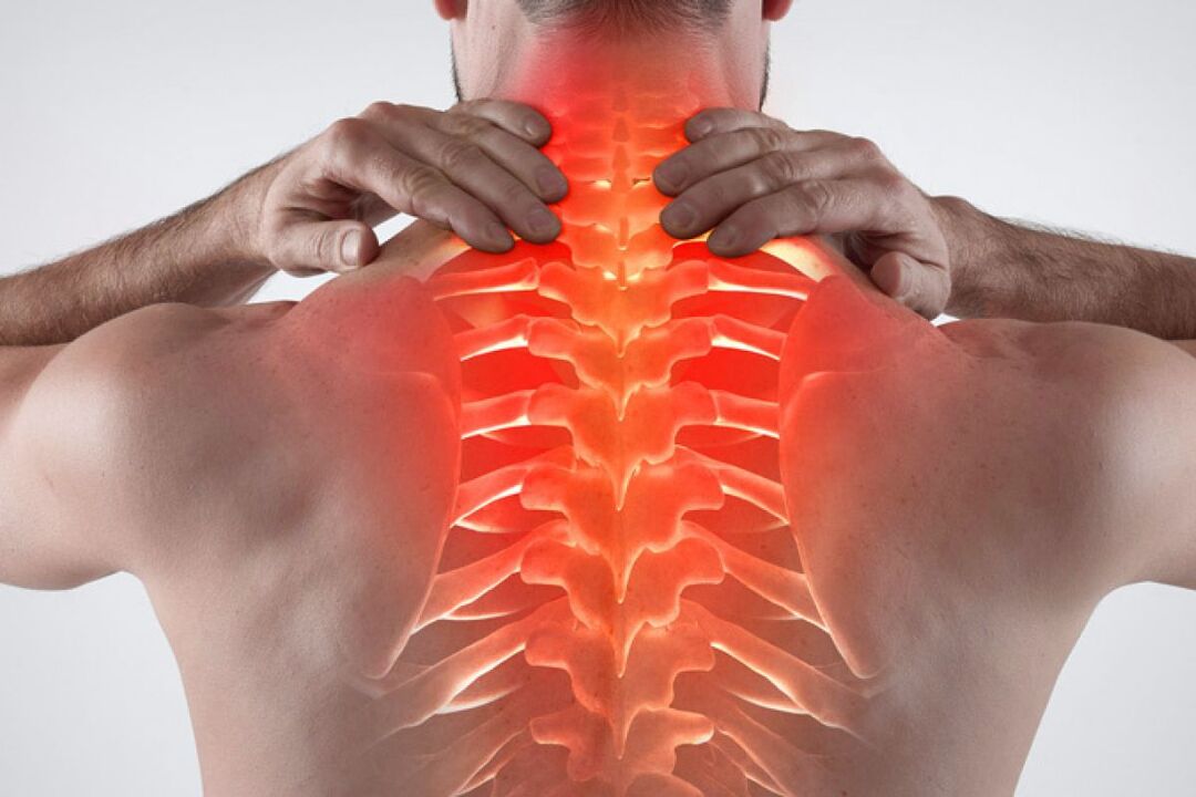 osteochondróza hrudnej chrbtice