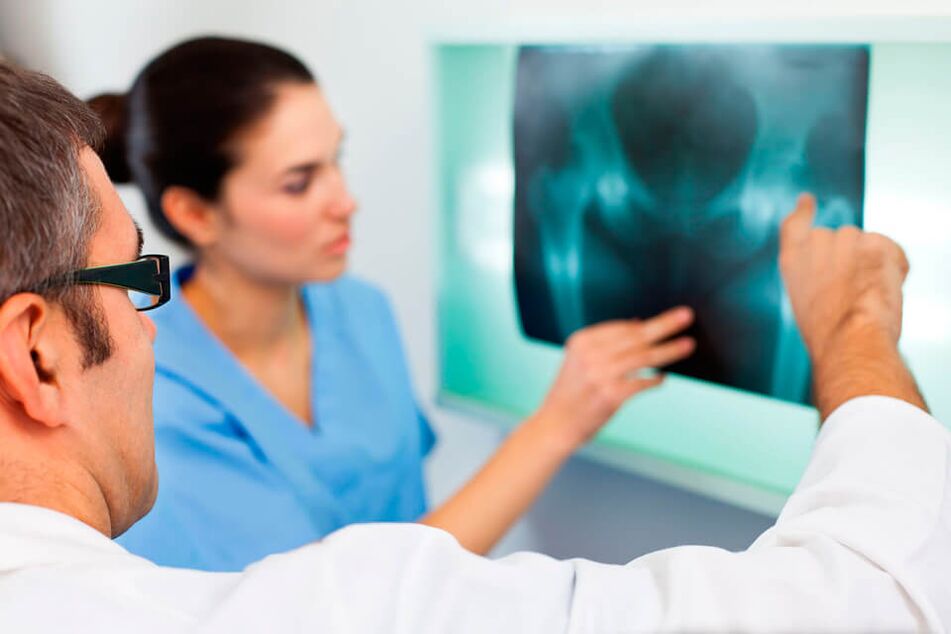 Reumatológ alebo traumatológ diagnostikuje bolesť v bedrovom kĺbe. 