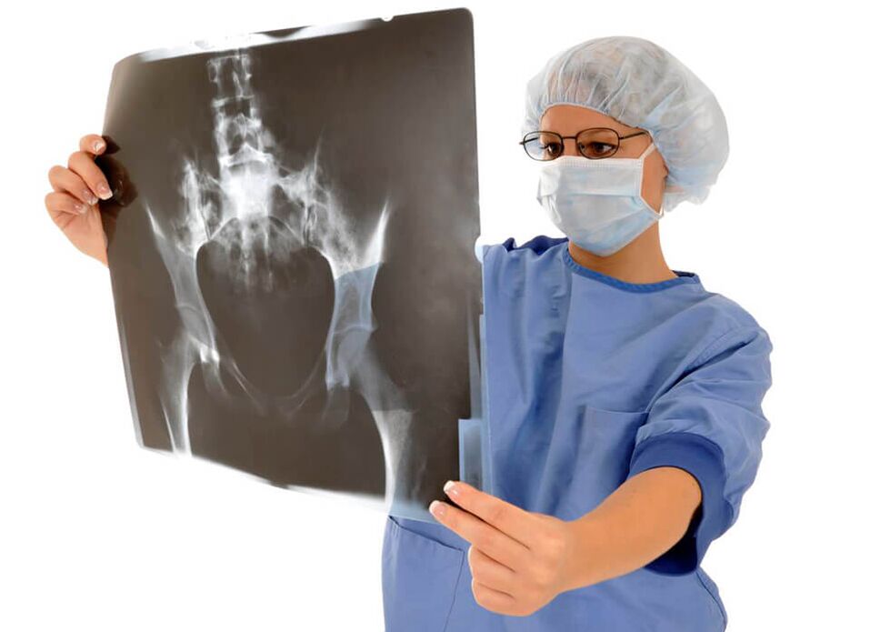 Röntgenové vyšetrenie bedrového kĺbu pomôže lekárovi určiť príčinu bolesti