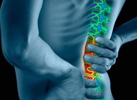 príčiny a príznaky osteochondrózy